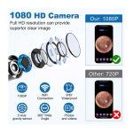 کیت تمیز کننده گوش دوربین دار مدل P60 برند Wolady - Image 6