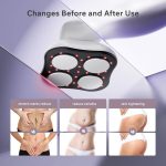 ماساژور پیکرتراشی حرفه ای سلولیت مدل F5 - Image 5