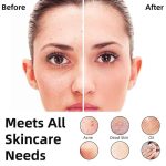 برس برقی پاک کننده صورت مدل L2 - Image 7